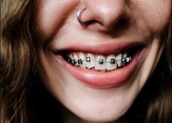 Photo: Creative Commons/Anna Avilova/pexels